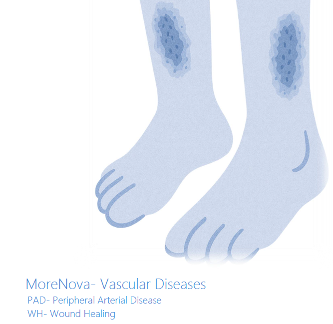 wound healing and PAD